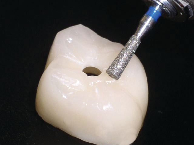 807/012PF - Inverted Cone Magic Touch Line - Zirconia & Lithium Endo Access