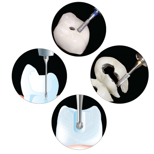 How to Perform a Root Canal with Strauss Diamond