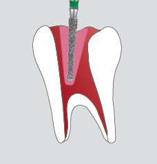 Endo Access