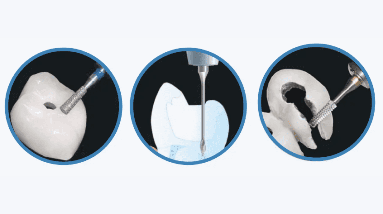 The Key to Endo Access