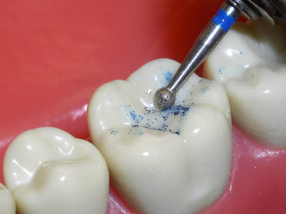 801/018PF - Round Magic Touch Line – Zirconia, Endo Access & Bite Adjustment
