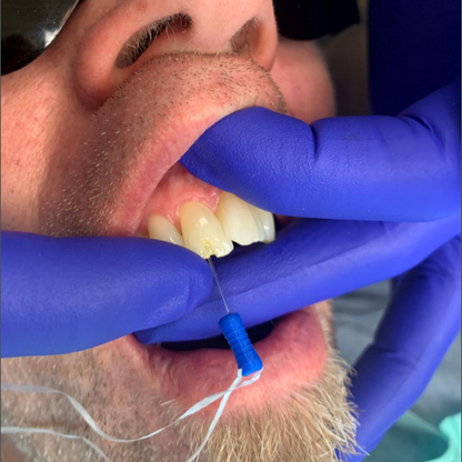 DentXPin Model Image