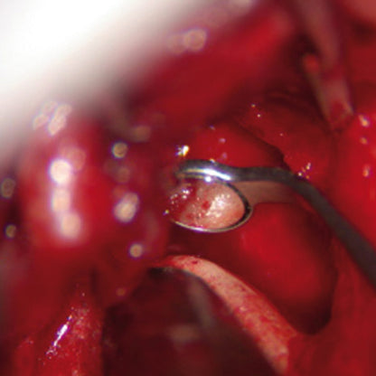 HD ULTRAmicro Ultra Bright FS Micro-Surgery Mirror