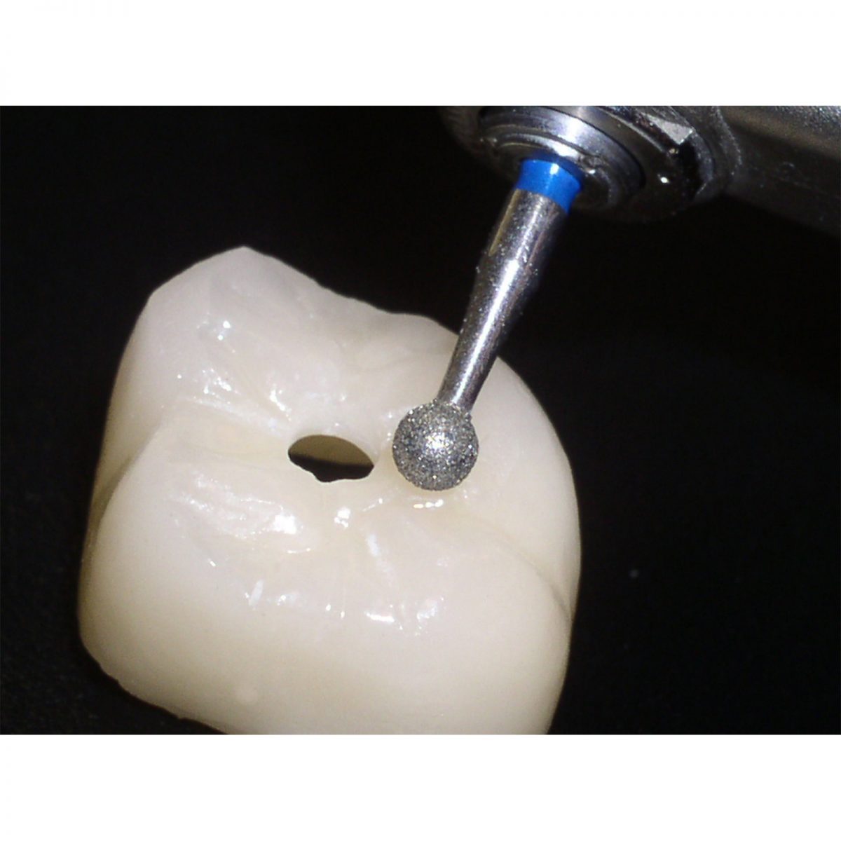 801/018PF - Round Magic Touch Line – Zirconia, Endo Access & Bite Adjustment
