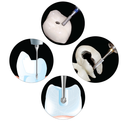The Key to Endo Access