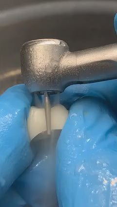 MTZCR1 - Zirconia & Lithium Disilicate Crown Removal