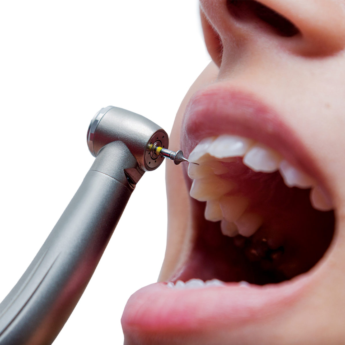 Orthodontic 2 Strauss Diamond