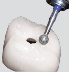 Endo Access on Zirconia