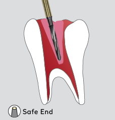 Safe-End EZ & Endo Access Z