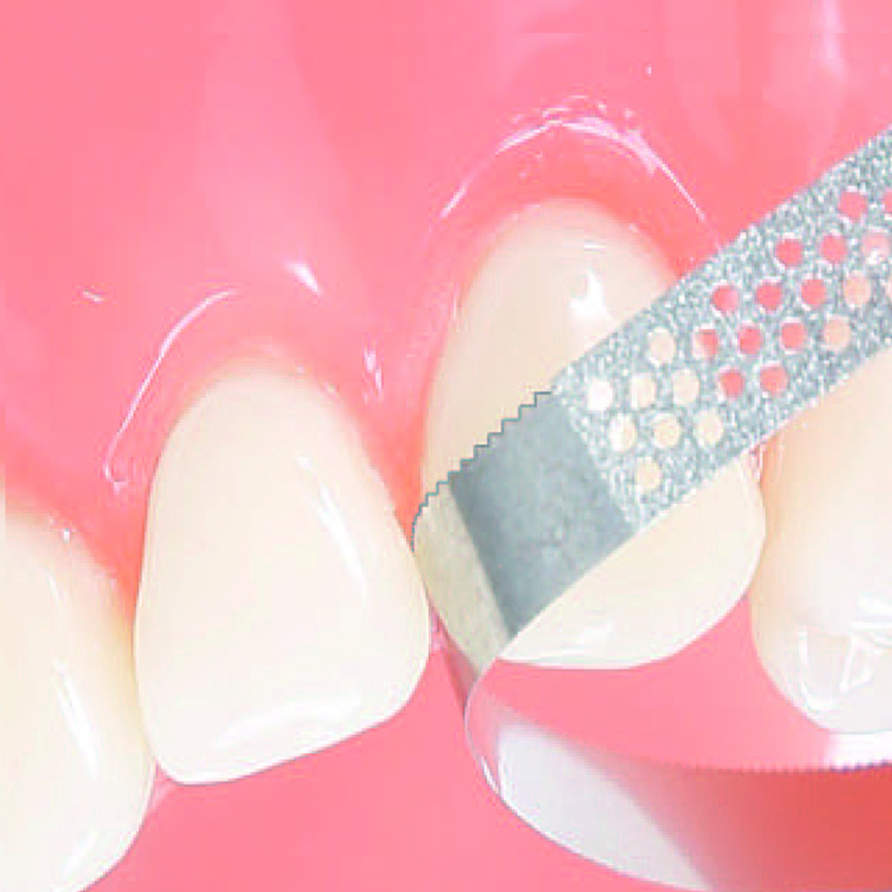 Serrated and Perforated