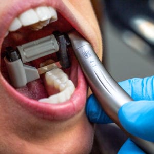 MSRSAW- Reciprocating Serrated Saw Magic Strip™