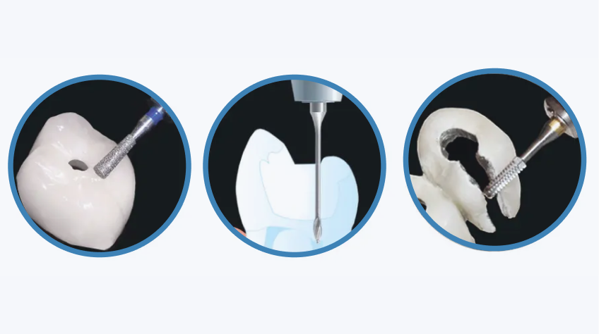 The Key to Endo Access Category Image