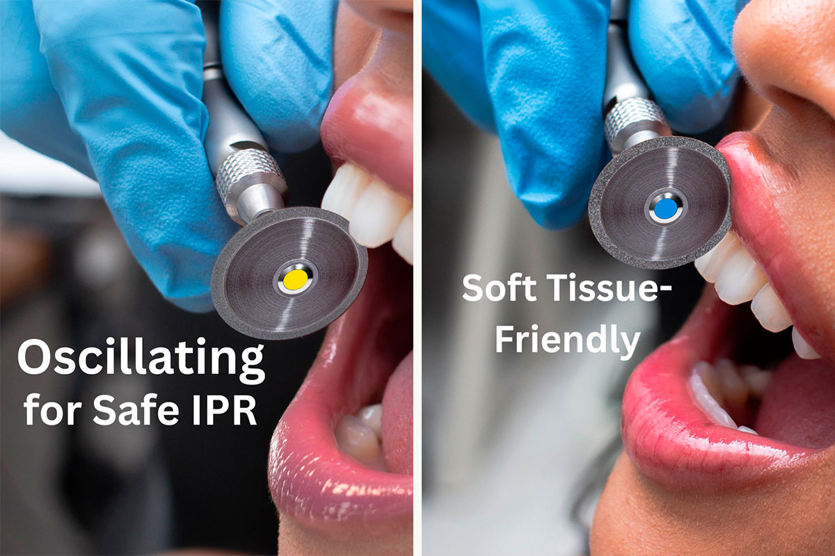 MagicGlide Individual Discs